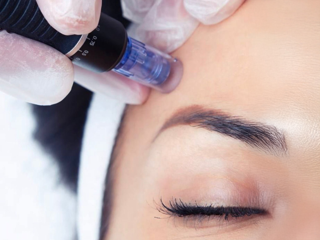 microneedling selani